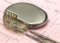 medical device pacemaker